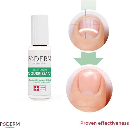 Poderm - Poderm Bitten Nails - 1-SOR-O-PIN-8 UKMEDI.CO.UK UK Medical Supplies